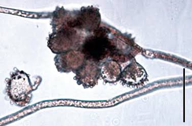 Glomeromycota or Glomeromycotina? The Rank Debate